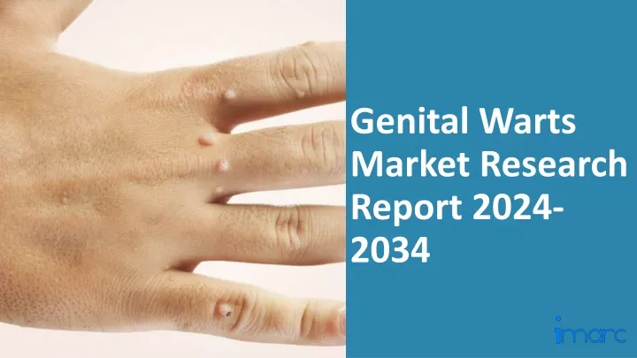 genital warts market research report 2024 2034