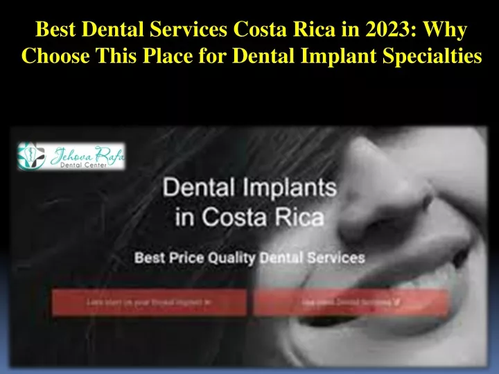 best dental services costa rica in 2023