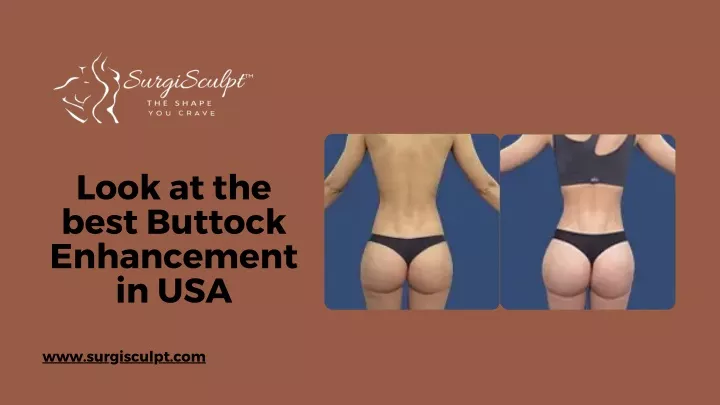 look at the best buttock enhancement in usa