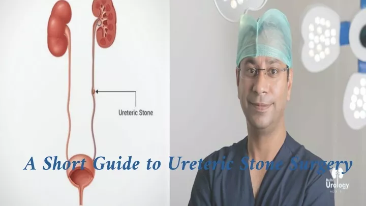 a short guide to ureteric stone surgery