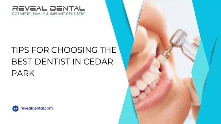 tips for choosing the best dentist in cedar park