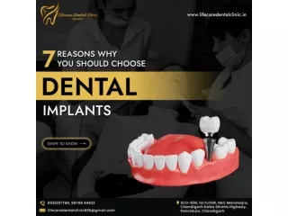 7 Reasons Why You Should Choose Dental Implants | LifecareDental