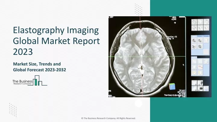 elastography imaging global market report 2023