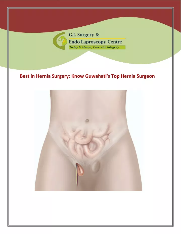 best in hernia surgery know guwahati s top hernia