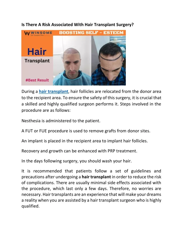 is there a risk associated with hair transplant