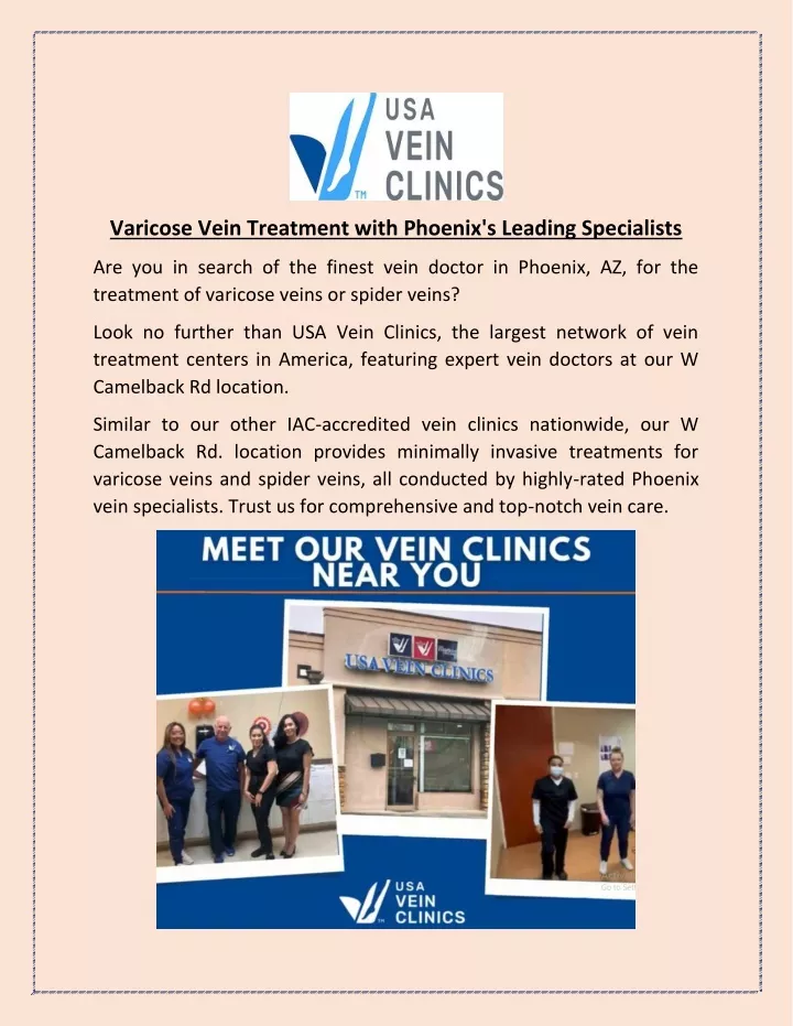 varicose vein treatment with phoenix s leading