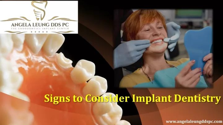 signs to consider implant dentistry
