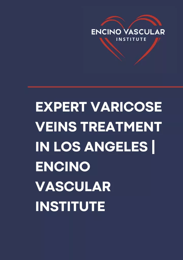 expert varicose veins treatment in los angeles