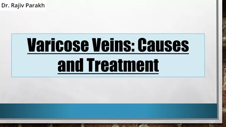 varicose veins causes and treatment