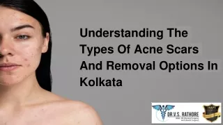 Understanding The Types Of Acne Scars And Removal Options In Kolkata