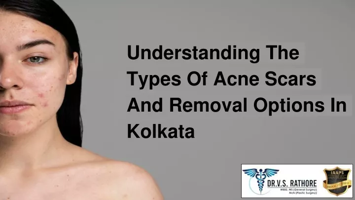 understanding the types of acne scars and removal