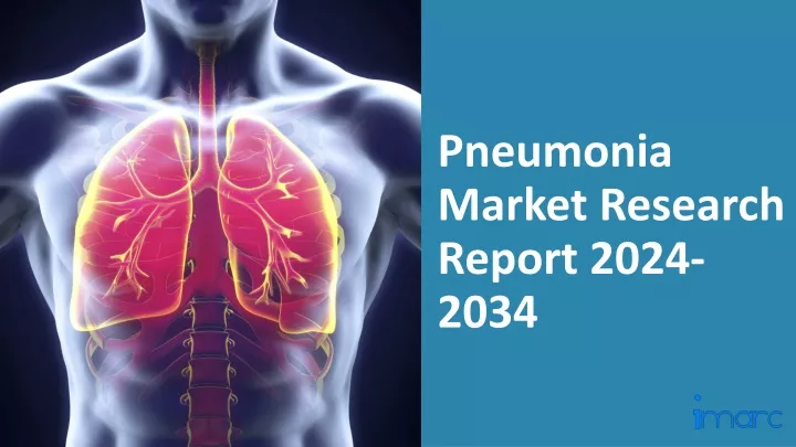 pneumonia market research report 2024 2034