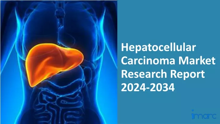 hepatocellular carcinoma market research report 2024 2034