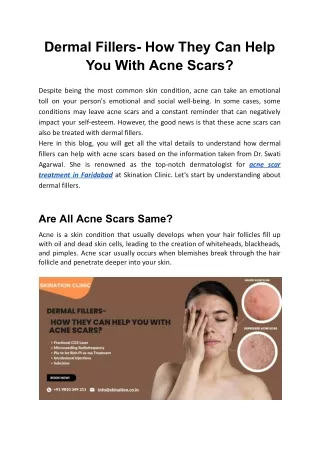 Dermal Fillers- How They Can Help You With Acne Scars