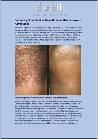 Embracing Smooth Skin: Oakville Laser Hair Removal's Advantages