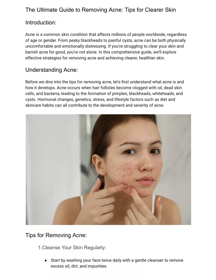 the ultimate guide to removing acne tips