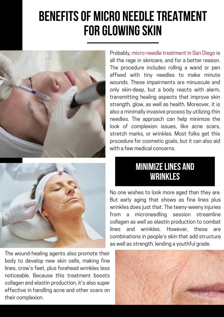 benefits of micro needle treatment for glowing