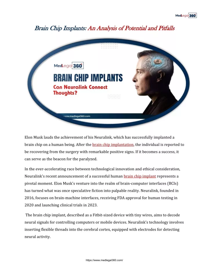 brain chip implants brain chip implants