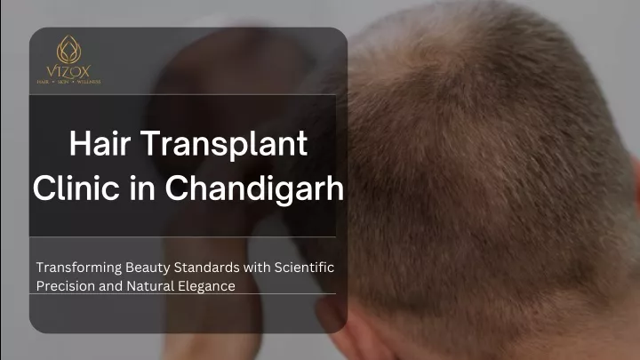 hair transplant clinic in chandigarh