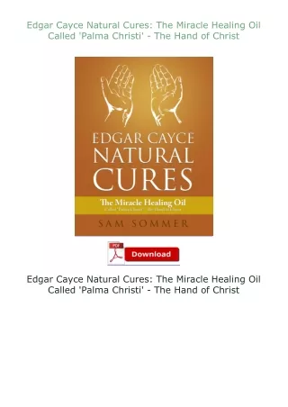 Edgar-Cayce-Natural-Cures-The-Miracle-Healing-Oil-Called-Palma-Christi--The-Hand-of-Christ