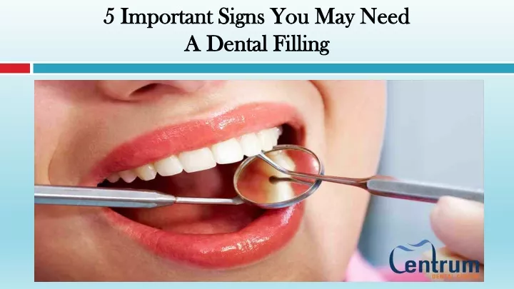 5 important signs you may need a dental filling