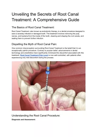 Unveiling the Secrets of Root Canal Treatment_ A Comprehensive Guide