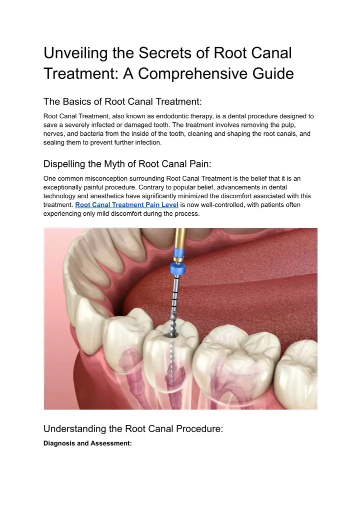 unveiling the secrets of root canal treatment