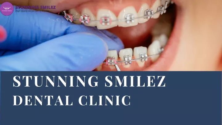 stunning smilez dental clinic