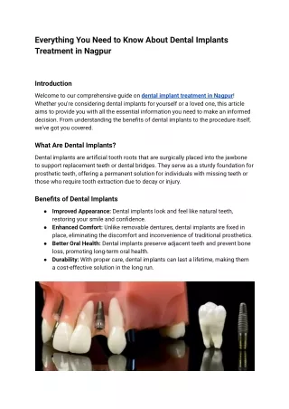 dental implants treatment in nagpur