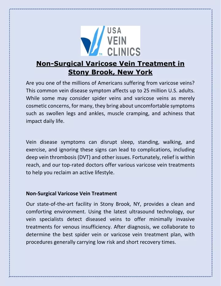 non surgical varicose vein treatment in stony