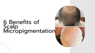 6 Benefits of Scalp Micropigmentation