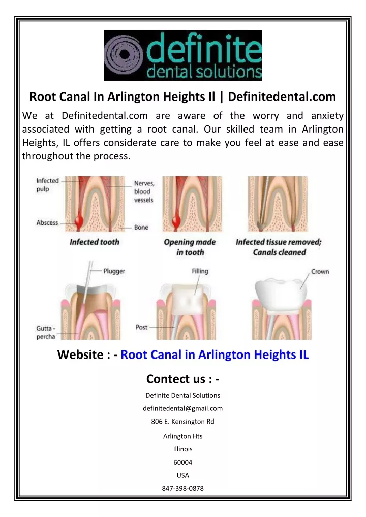 root canal in arlington heights il definitedental