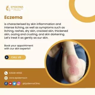 Eczema | Best Skin Clinic in Jayanagar Bangalore | Epiderma Skin and Hair Clinic