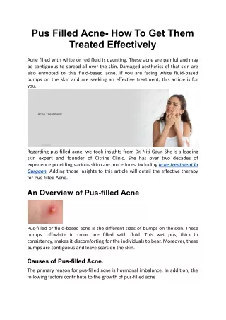 Pus Filled Acne- How To Get Them Treated Effectively