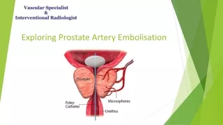 Exploring Prostate Artery Embolisation