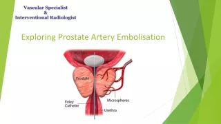 exploring prostate artery embolisation