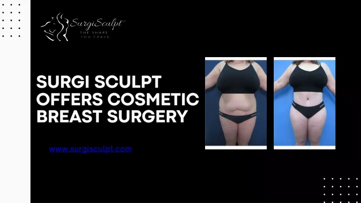 surgi sculpt offers cosmetic breast surgery