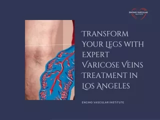 Transform Your Legs with Expert Varicose Veins Treatment in Los Angeles