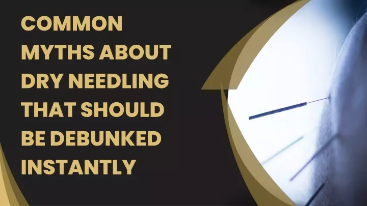 common myths about dry needling that should