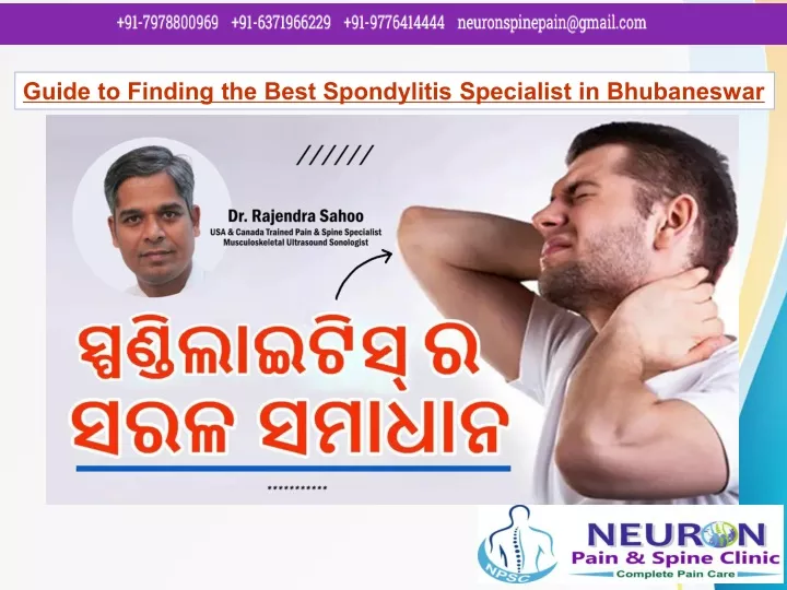 guide to finding the best spondylitis specialist
