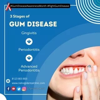 Stages of Gum Disease | Dental Clinic in Bellandur, Bangalore | Nelivigi Dental