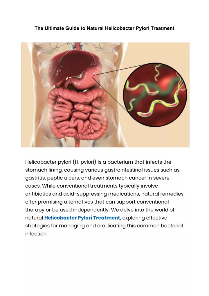 the ultimate guide to natural helicobacter pylori