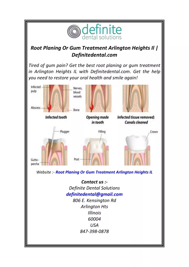 root planing or gum treatment arlington heights