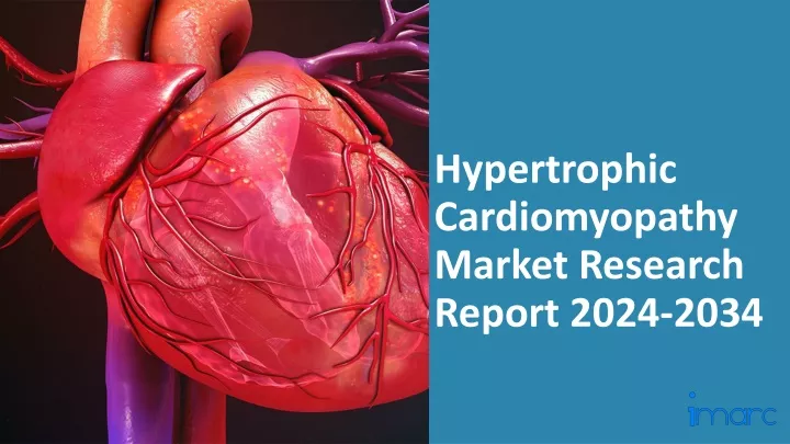 hypertrophic cardiomyopathy market research report 2024 2034