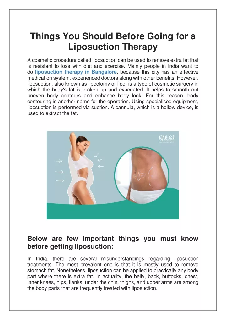 things you should before going for a liposuction