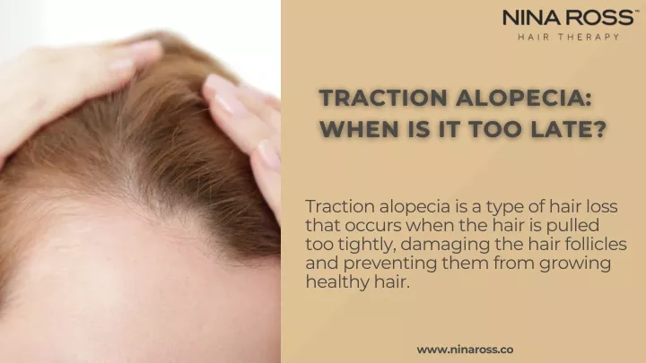 traction alopecia is a type of hair loss that