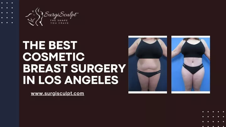 the best cosmetic breast surgery in los angeles