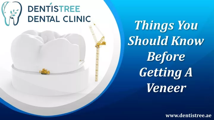 things you should know before getting a veneer