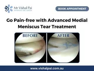 Go Pain-free with Advanced Medial Meniscus Tear Treatment