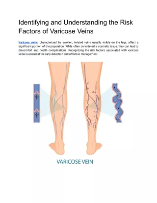 Identifying and Understanding the Risk Factors of Varicose Veins